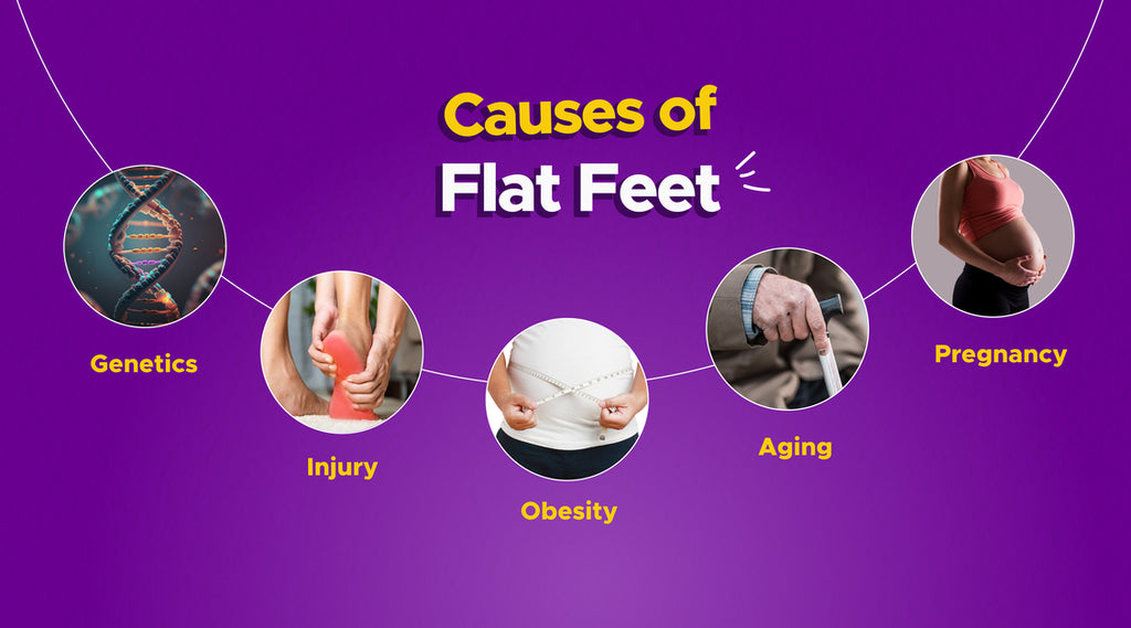 Flat feet: Causes and Symptoms - MyFrido