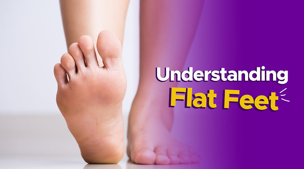 Flat Feet: Exercise and Physical Therapy - MyFrido