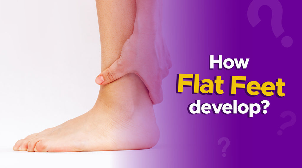 What are flat feet and how do they develop? - MyFrido