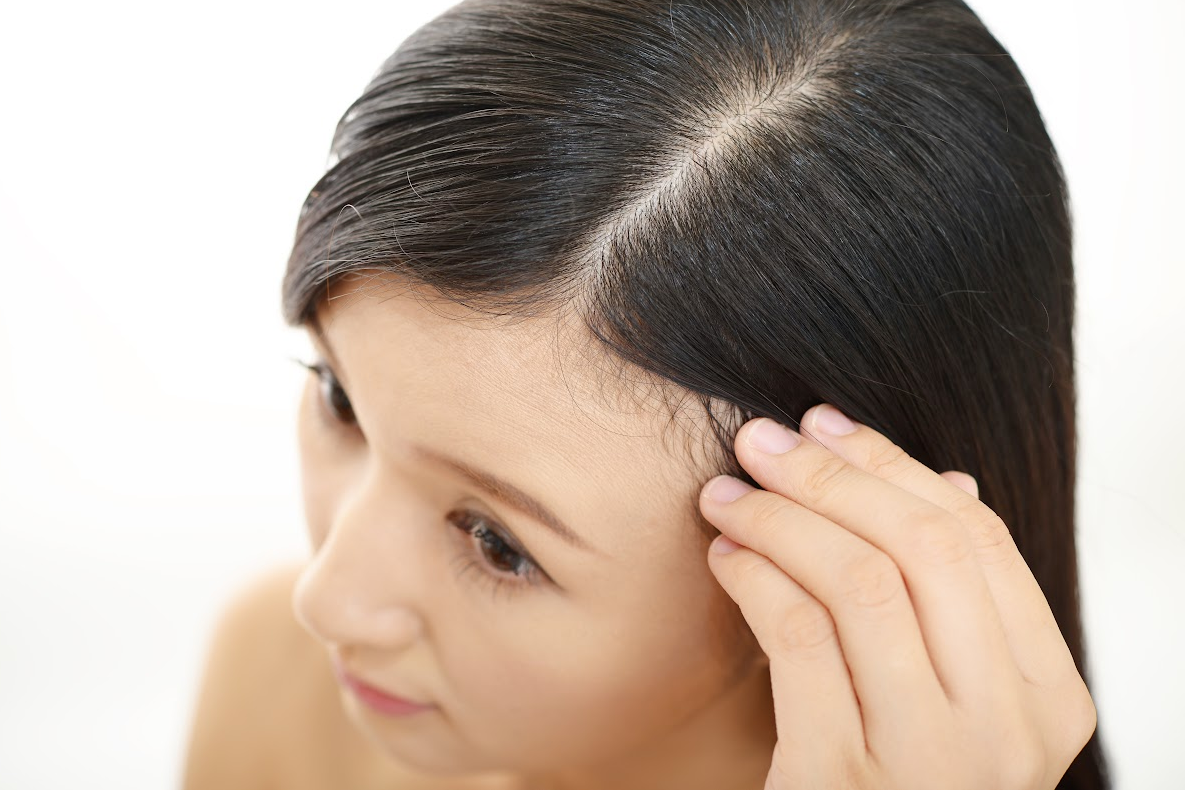 Benefits Of Lemongrass Essential Oil For Hair