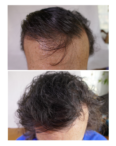 before and after of scalp treated with Seaspray showing greater hair volume
