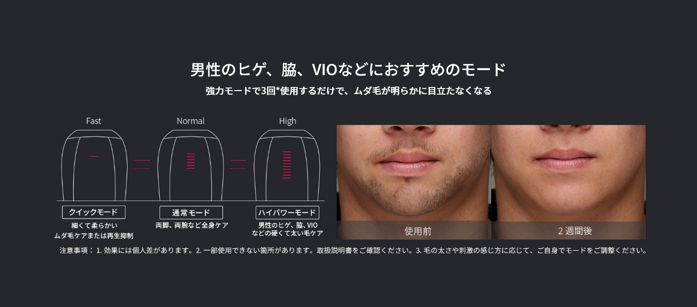 男性のヒゲ、脇、VIOなどにおすすめのモード