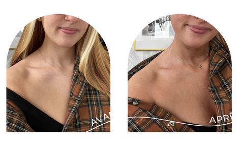 innovaderm-esthetique-bronzage-avant-apres