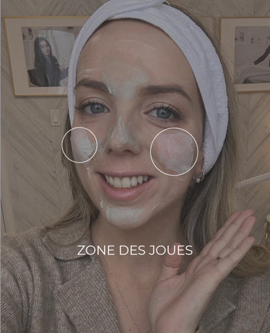 multimasking zone des joues