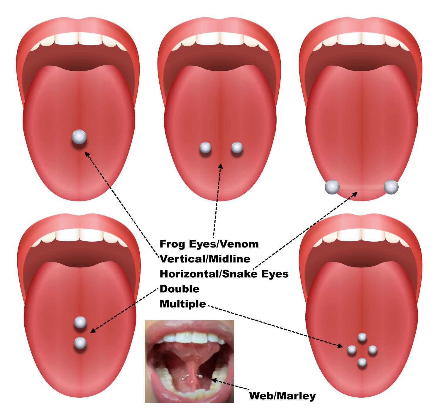 Tongue Piercing: A Complete Rundown Of The Key Elements ...
