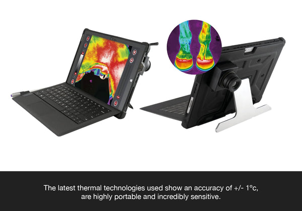 The latest thermal technologies used show an accuracy of +/- 1ºc,  are highly portable and incredibly sensitive. 