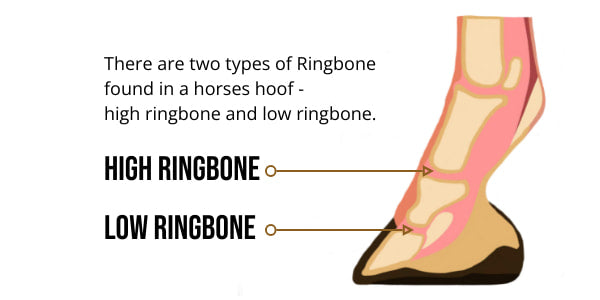 There are two types of ringbone found in horses. Low ringbone and high ringbone.