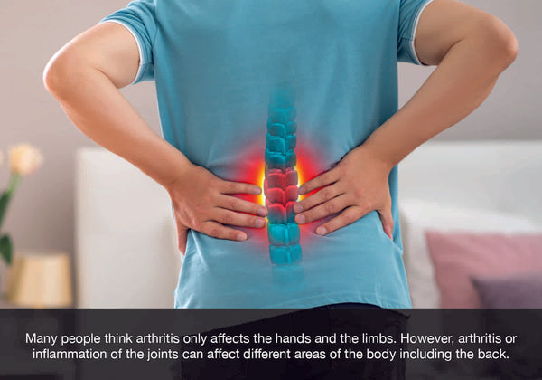 Osteoarthritis or inflammation of the joints can affect different areas of the body including the back.