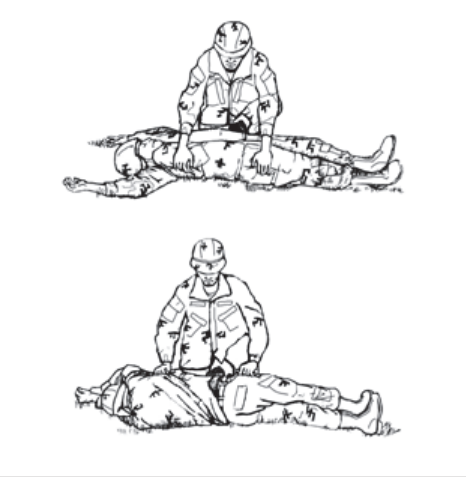 Figure 1-1. Positioning the casualty on his abdomen 
