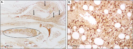 Sections of Paw from CIA Model Stained for Macrophage IHC Marker CD206
