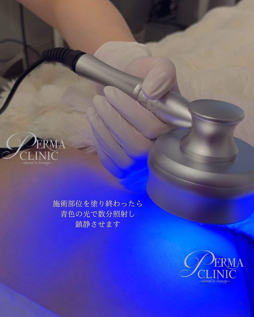 メラニンケア Case 6