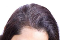 Grey Roots On Womans Head