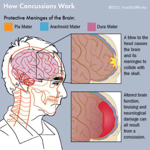 What happens during concussion
