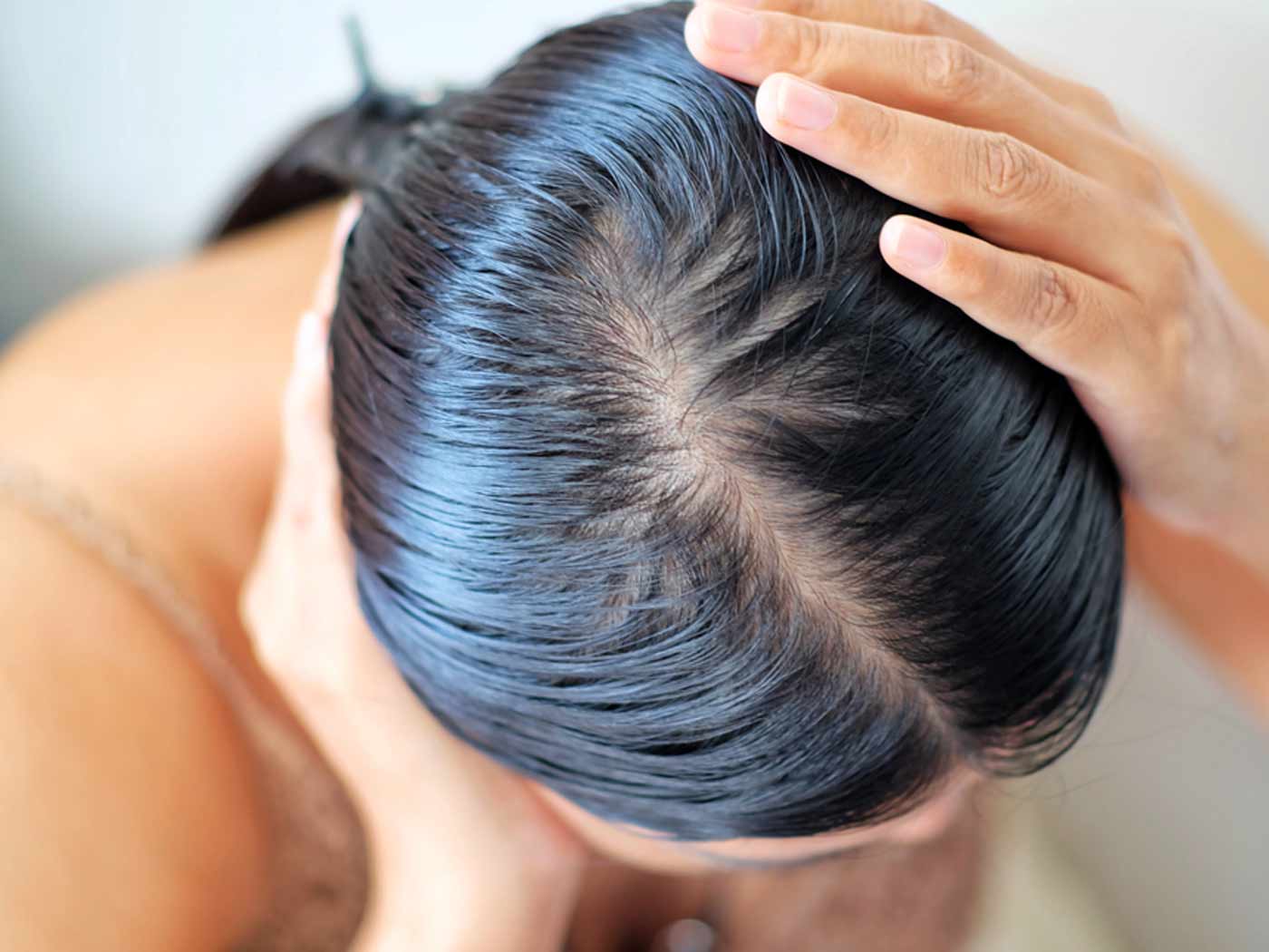 Oily Hair: How to get rid of Oily Hair without Washing - Pure Sense
