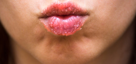 exfoliate lips