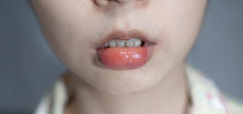 lips swelling causes