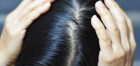 home remedies for oily scalp and dry hair
