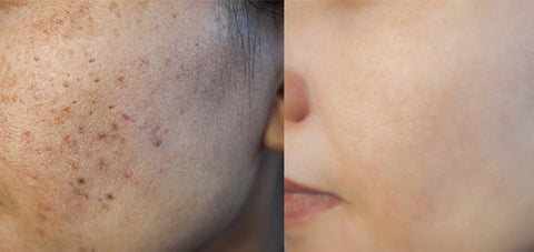 benefits of moisturizer on face