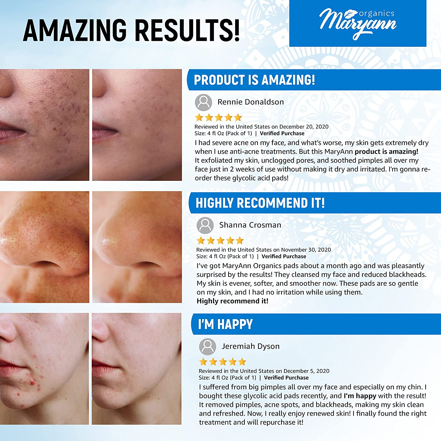 Maryann 30% Glycolic Acid Pads