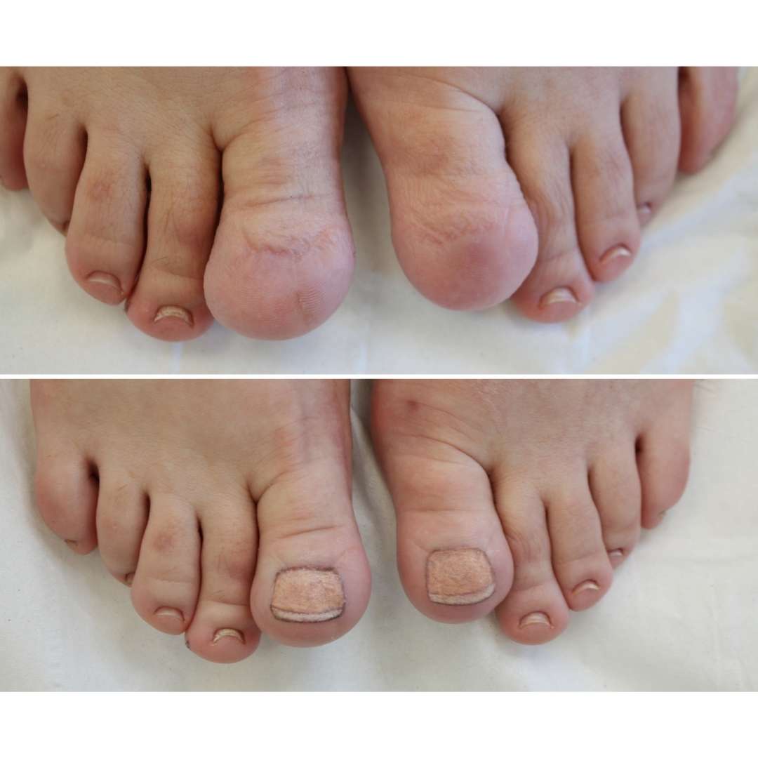 toenail 2 1652884460065