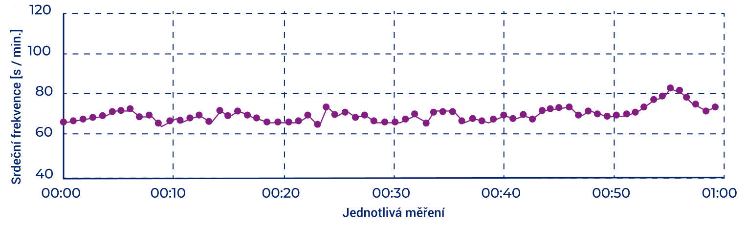 Variability srdečního tepu - před použitím přístroje Somavedic