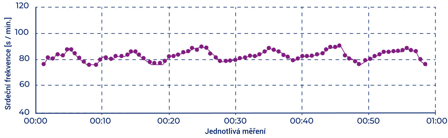 Variability srdečního tepu - po použití přístroje Somavedic