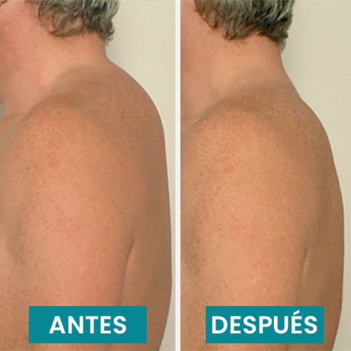 BEFORE-AFTER3 copia.webp__PID:57401466-a969-447a-ae2c-88dce68b7466