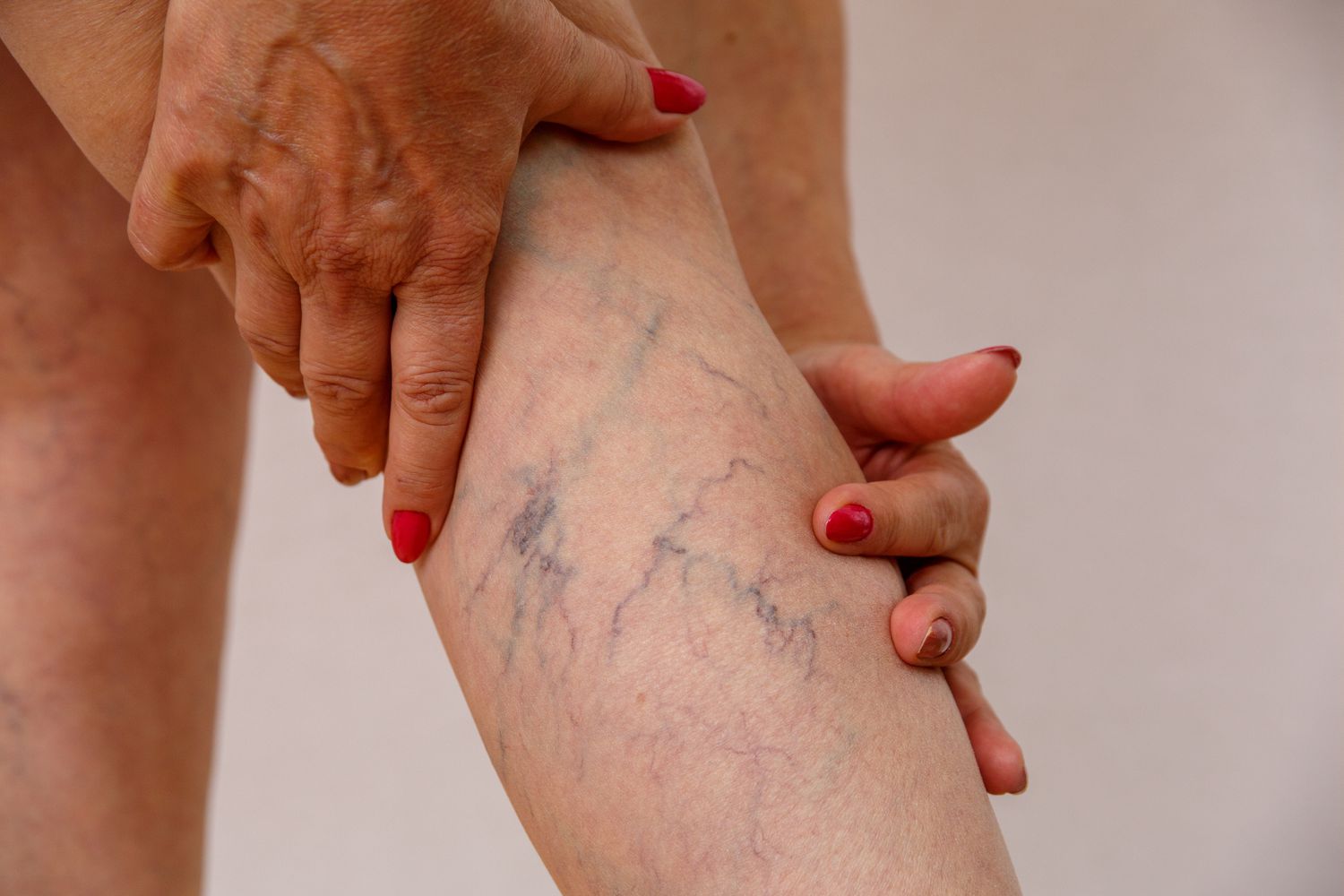 elderly-woman-shows-varicose-1145186766-cfb1326c1dac4189bbc78ca19847128b.jpg__PID:f92f2b73-b928-4ec7-85a4-f626f7238398
