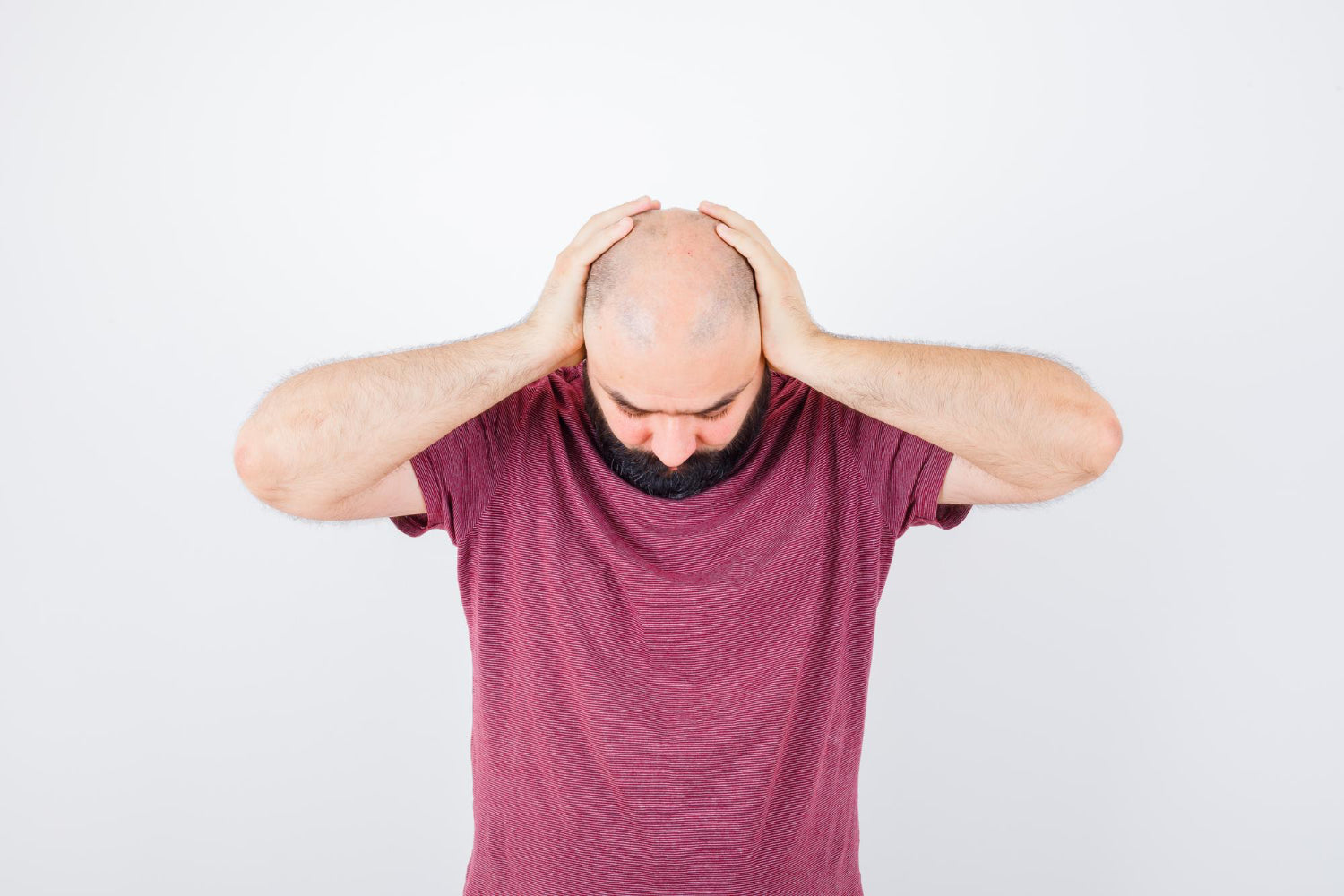 Hair loss in men is solely caused by genetics