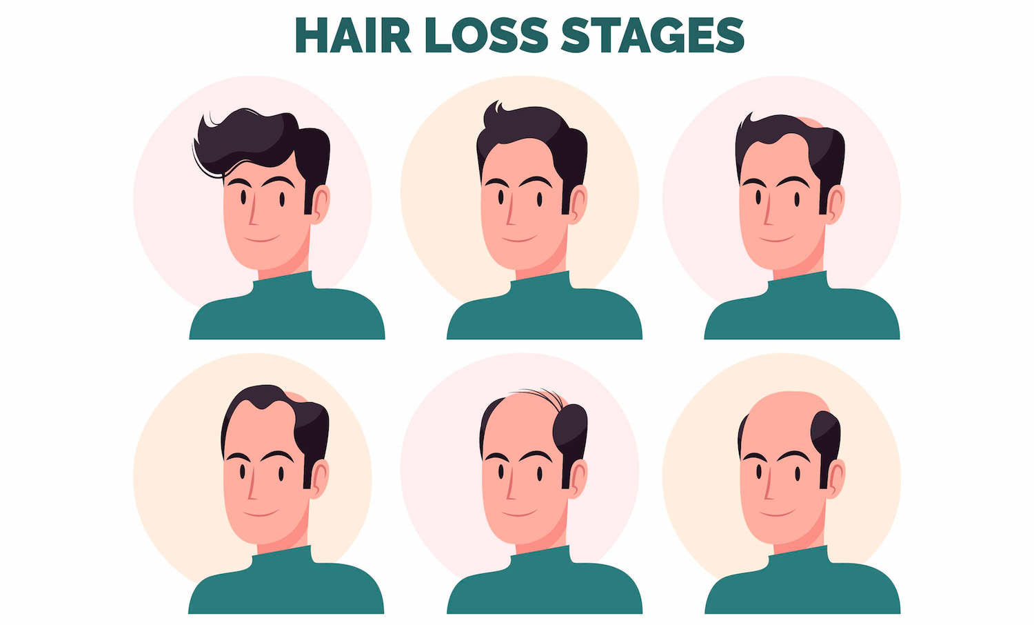 Relationship Between Stress and Hair Loss