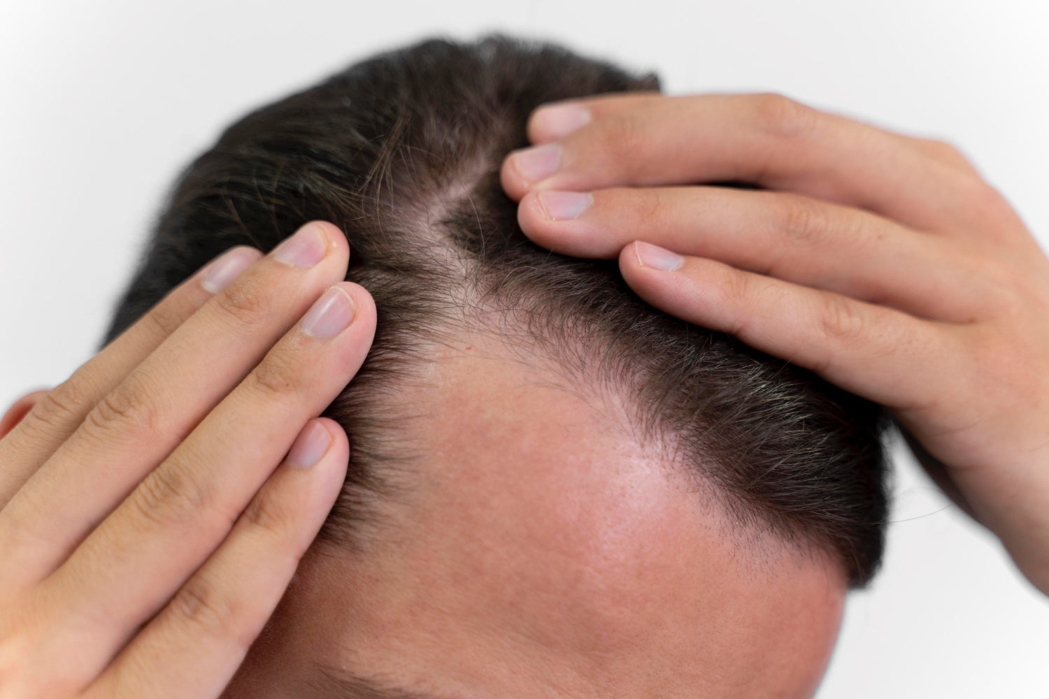 Scalp massage can prevent hair loss