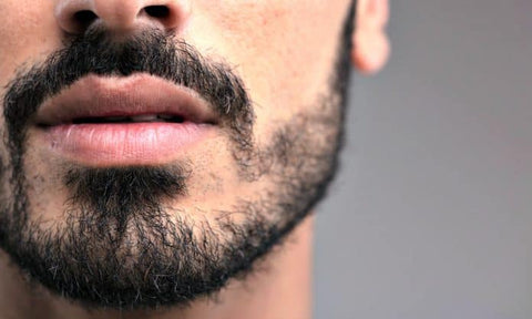 thin-patchy-beard