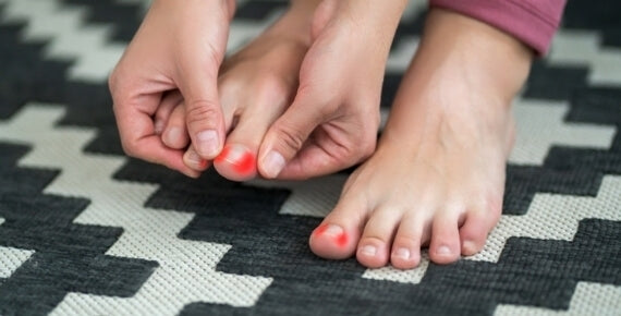 Causes of ingrown toenails