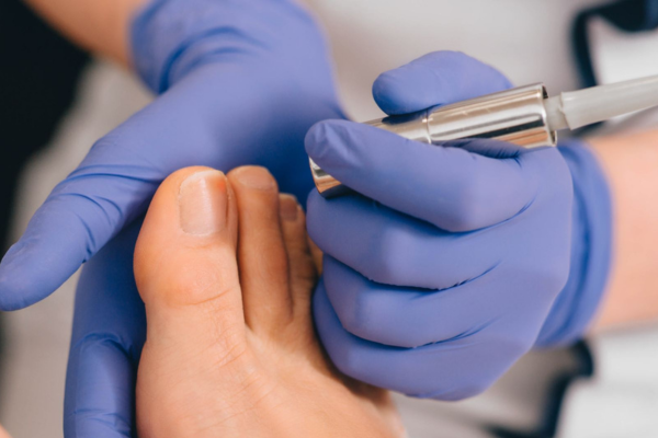 What ingrown toenails are and the discomfort they cause