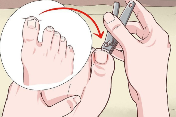 Replace your nail clippers every year