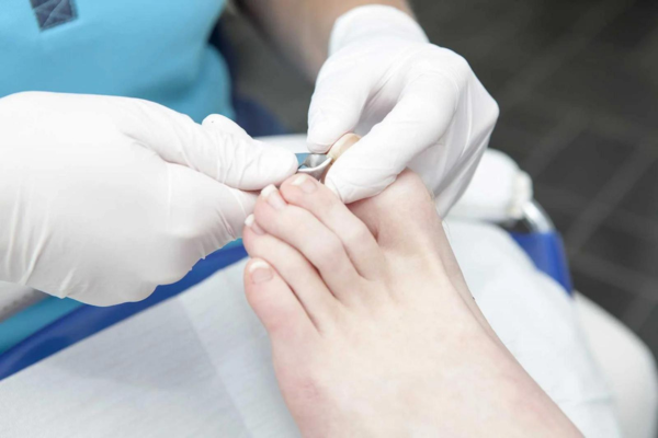 How are ingrown toenail treated?