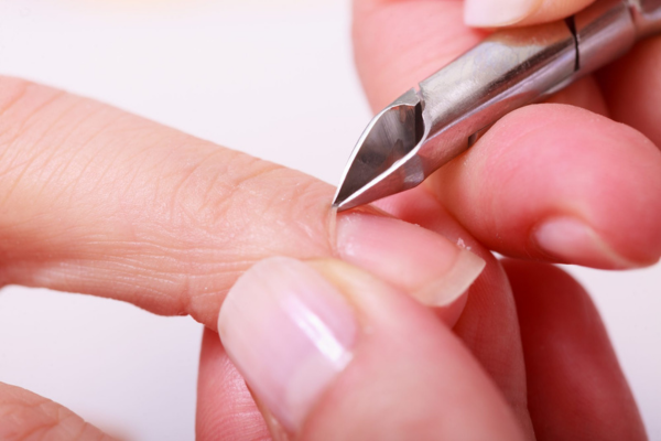 tips for dealing with three common cuticle issues