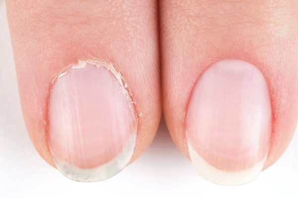 Why push back cuticles