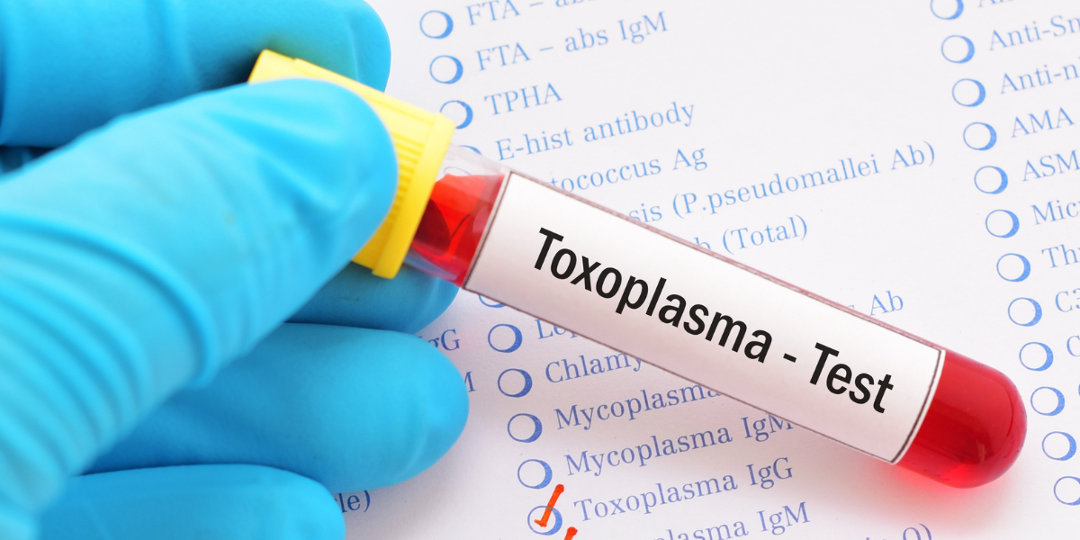 Toxoplasmosis and cats. Vile being held with blood to test for toxoplasmosis