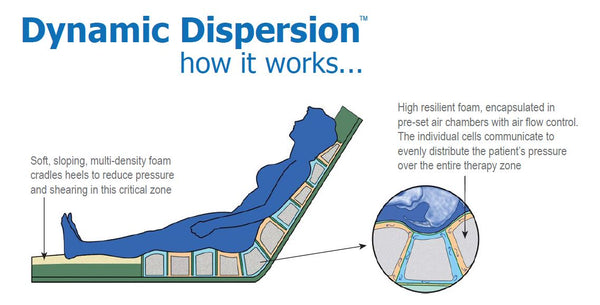 Dynamic Dispersion Foam Mattress