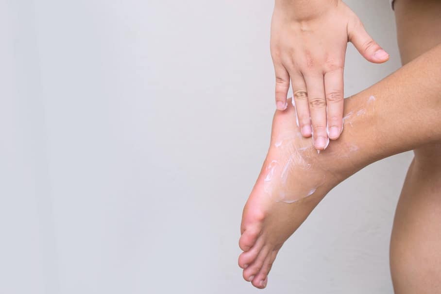 A women Ningen marigold cream applying on feet