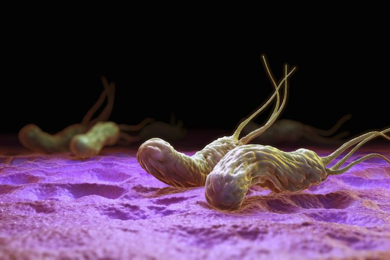 H. Pylori- A Different Approach