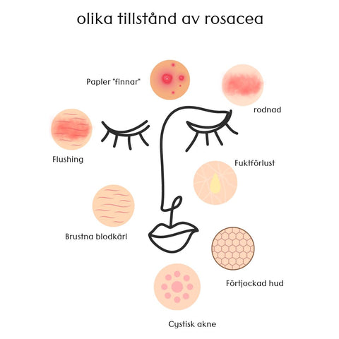 Bilden beskrive olika tillstånd av rosacea