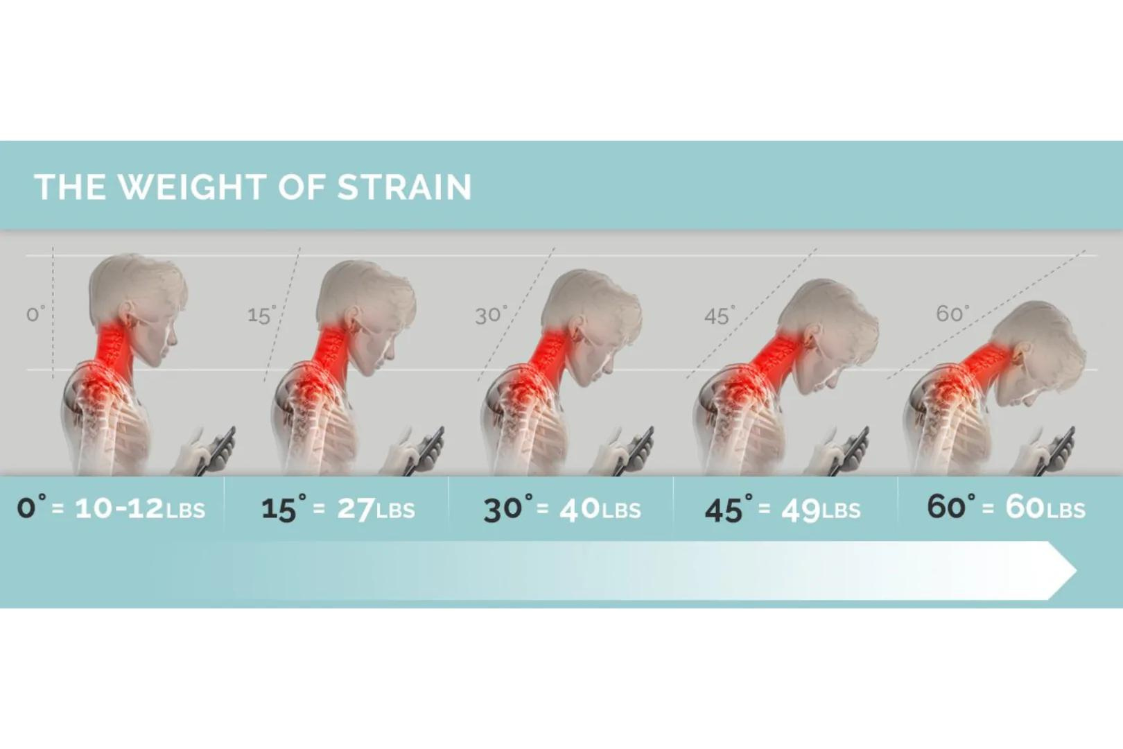 Types of posture