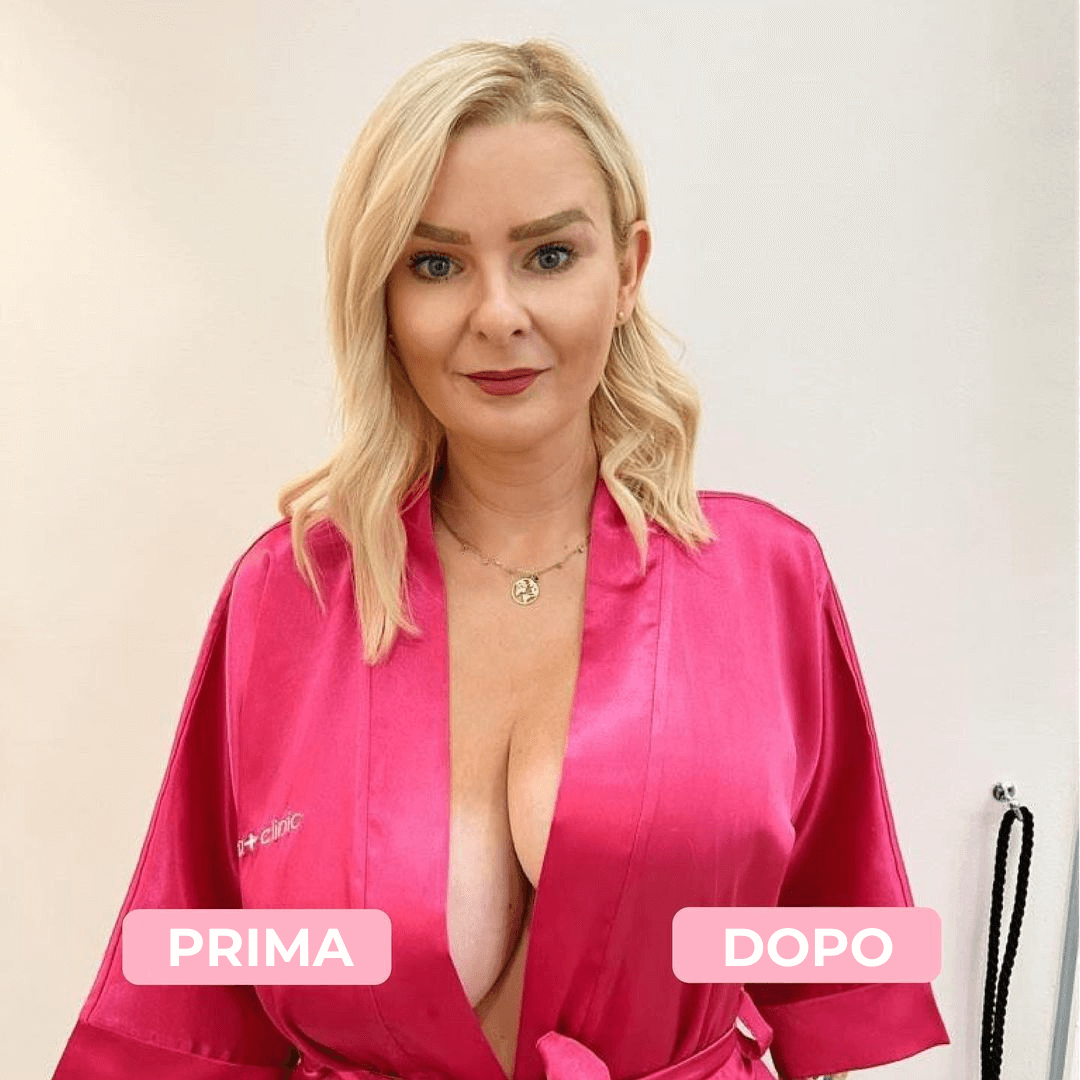 Dpm tapes Boobs & Body Tapes – Reggiseno Adesivo per Sollevamento del Seno,  Delicato sulla Pelle, Push