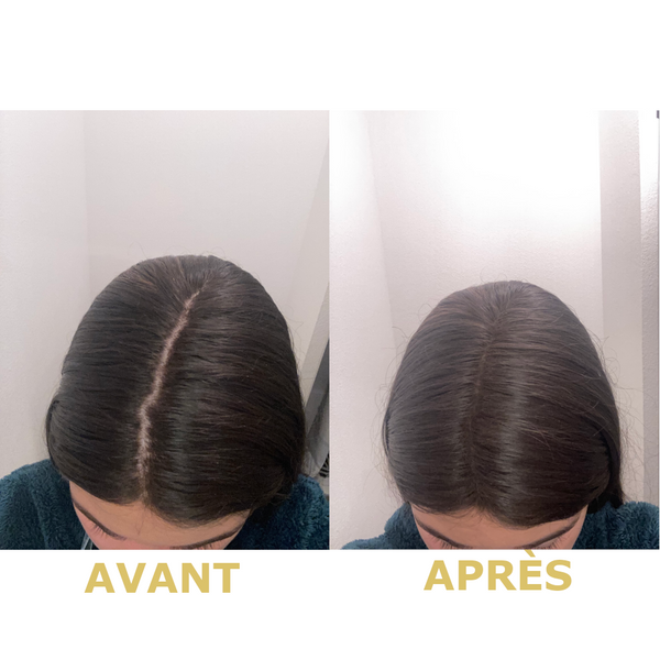 Raie de cheveux clairsemée : une solution efficace pour la ...