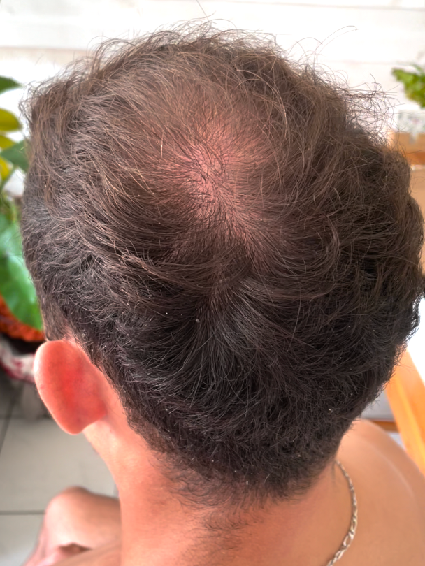 Les dangers de la poudre densifiante pour cheveux – Avey