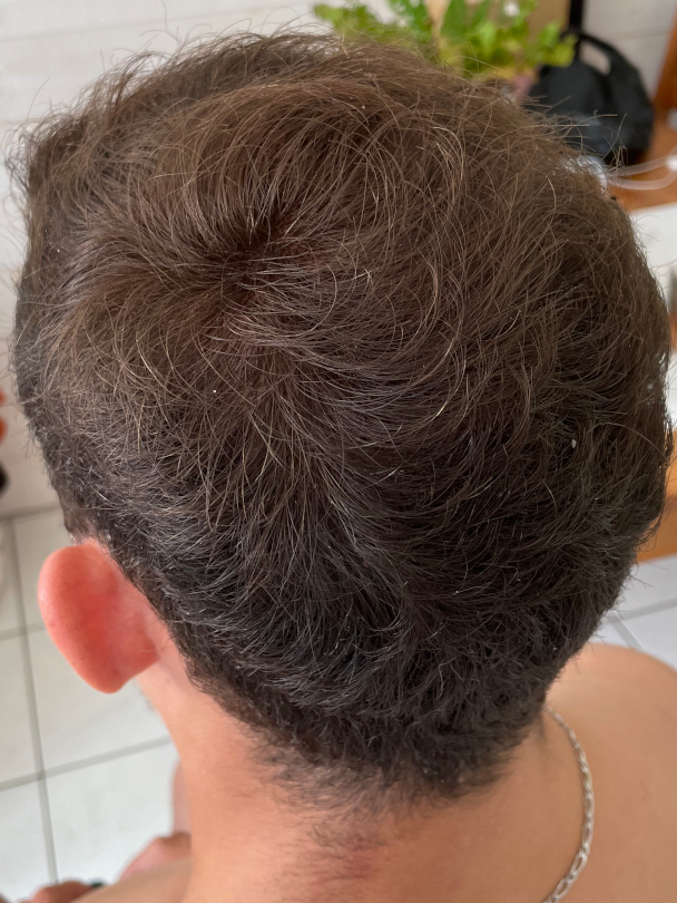 Cheveux homme après avoir appliqué de la poudre densifiante