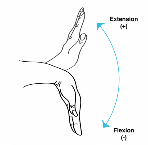 Wrist Hyperextension