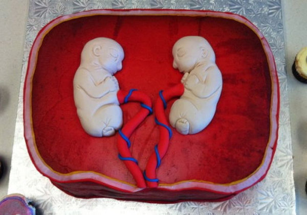 [Baby Shower[ Epic Fails: Disaster Cakes That Will Make You Cringe] - [Twin Fetuses Cake]